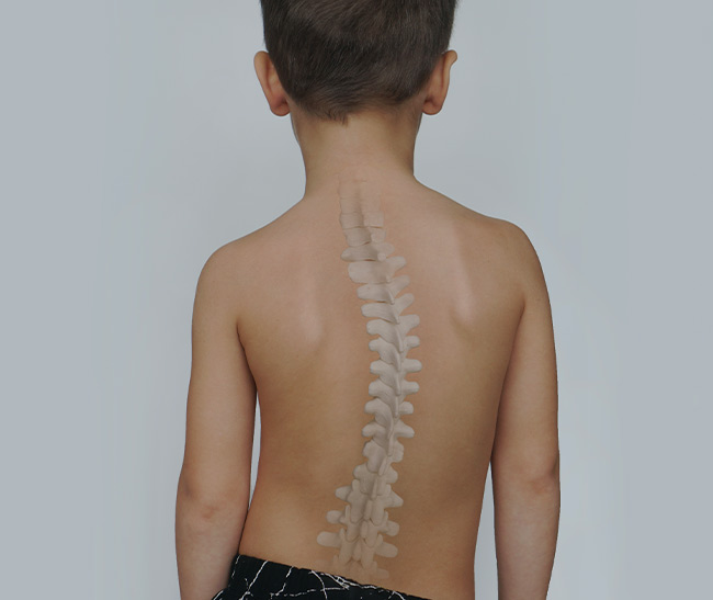 Physiotherapiepraxis Kronenberg Skoliose